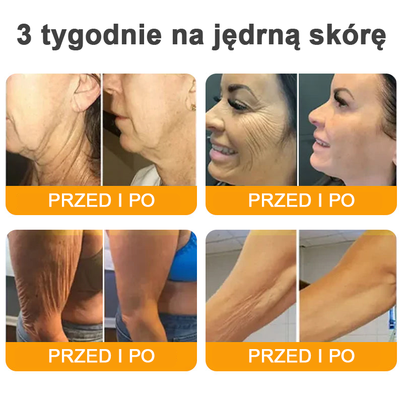 🔥🔥🔥🔥VLSVLS® Krem z jadem pszczelim do regeneracji skóry (👨⚕ odpowiedni dla wszystkich grup wiekowych, polecany przez AAD)