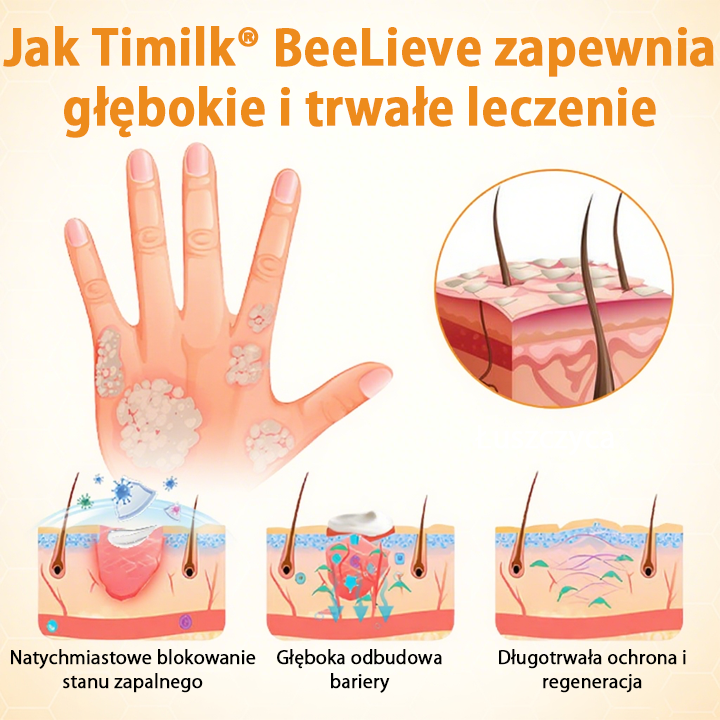 Timilk® BeeLieve Łuszczyca Pielęgnacja skóry🌿🌿🌿