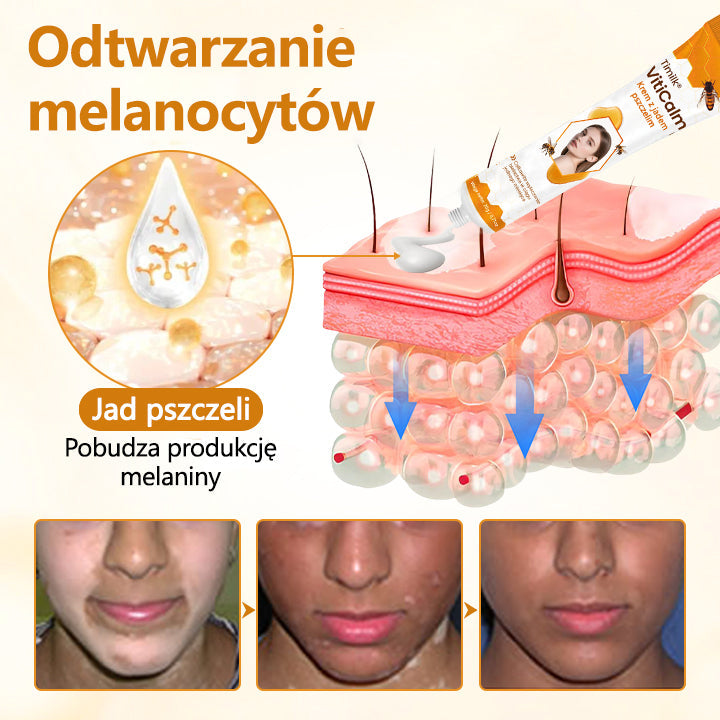 ✨✨✨Timilk® VitiCalm krem z jadem pszczelim