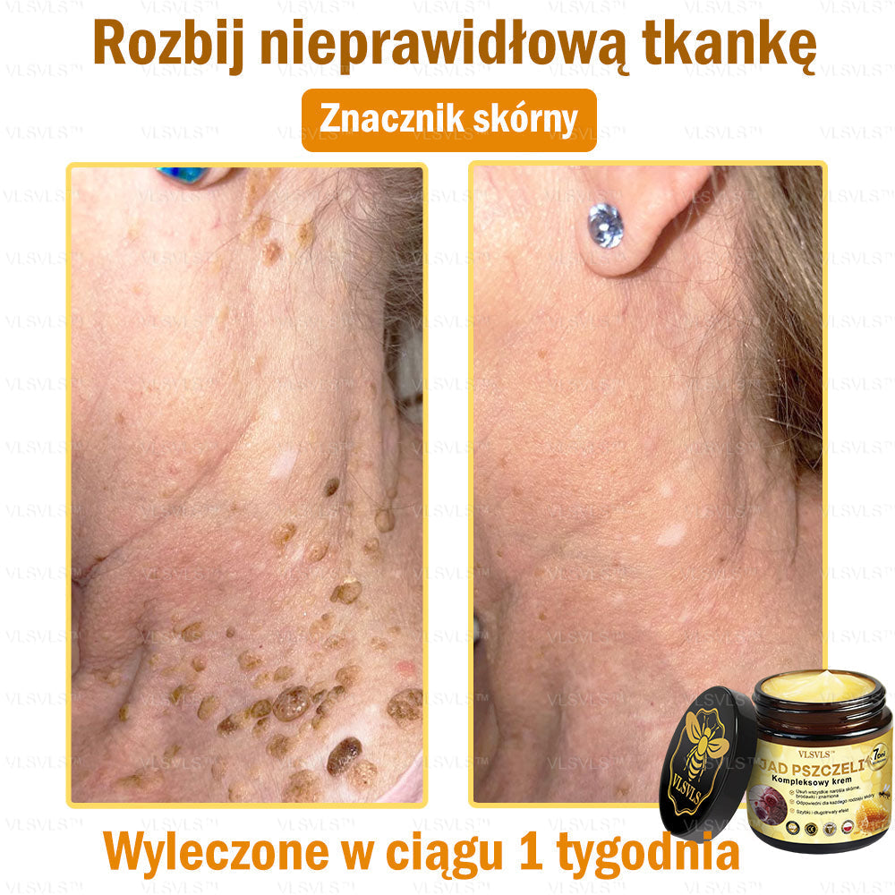 VLSVLS™ Krem Komprehensywny z Jadami Pszczół 🇵🇱 Rekomendowany przez Dermatologów