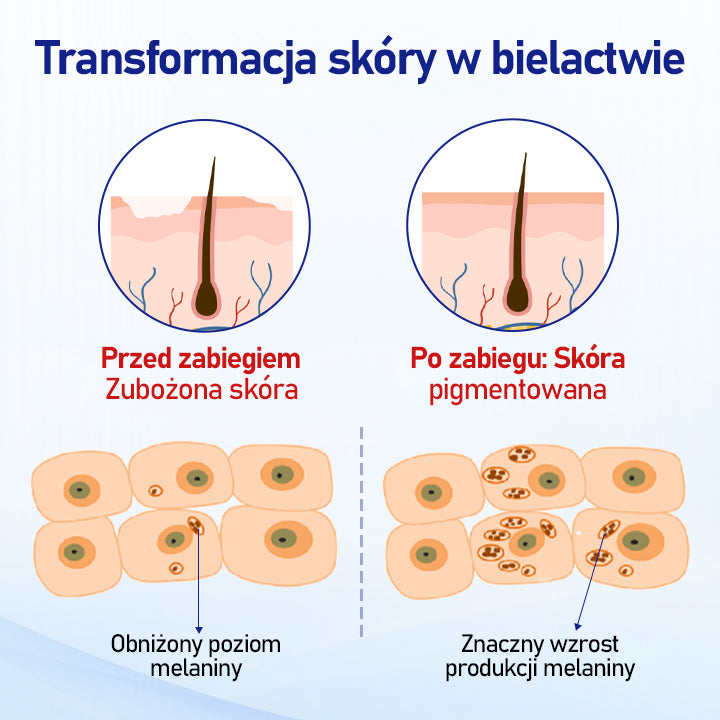 ⭐⭐⭐⭐Timilk® VitiClear Spray ziołowy