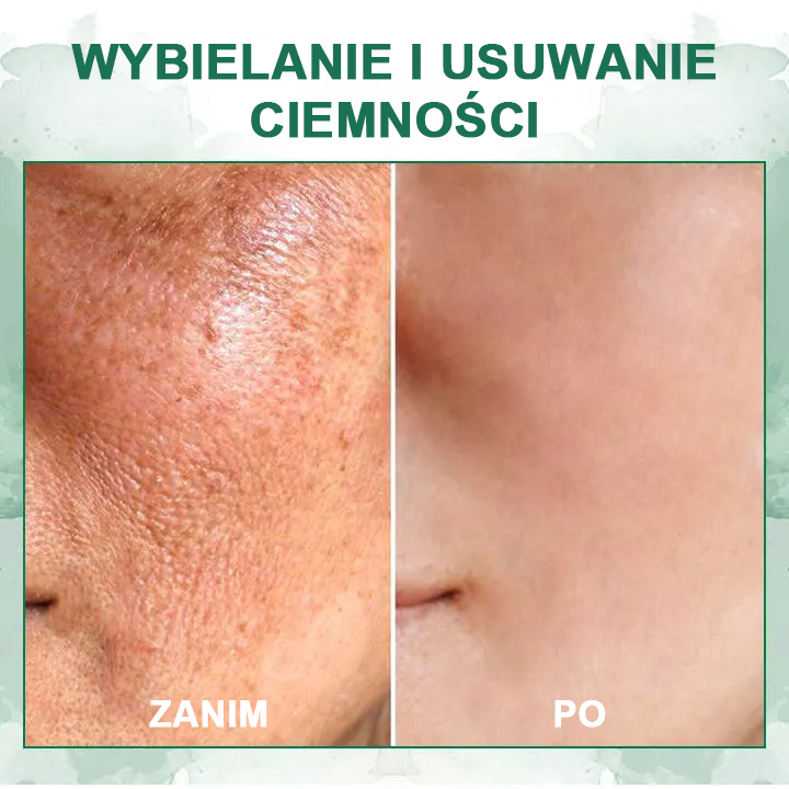 🌿🌿🌿🌿Ostatni dzień promocji 60% Zniżki - Fubsta™ Serum odmładzające ujędrniające skórę🔥🔥🔥🔥
