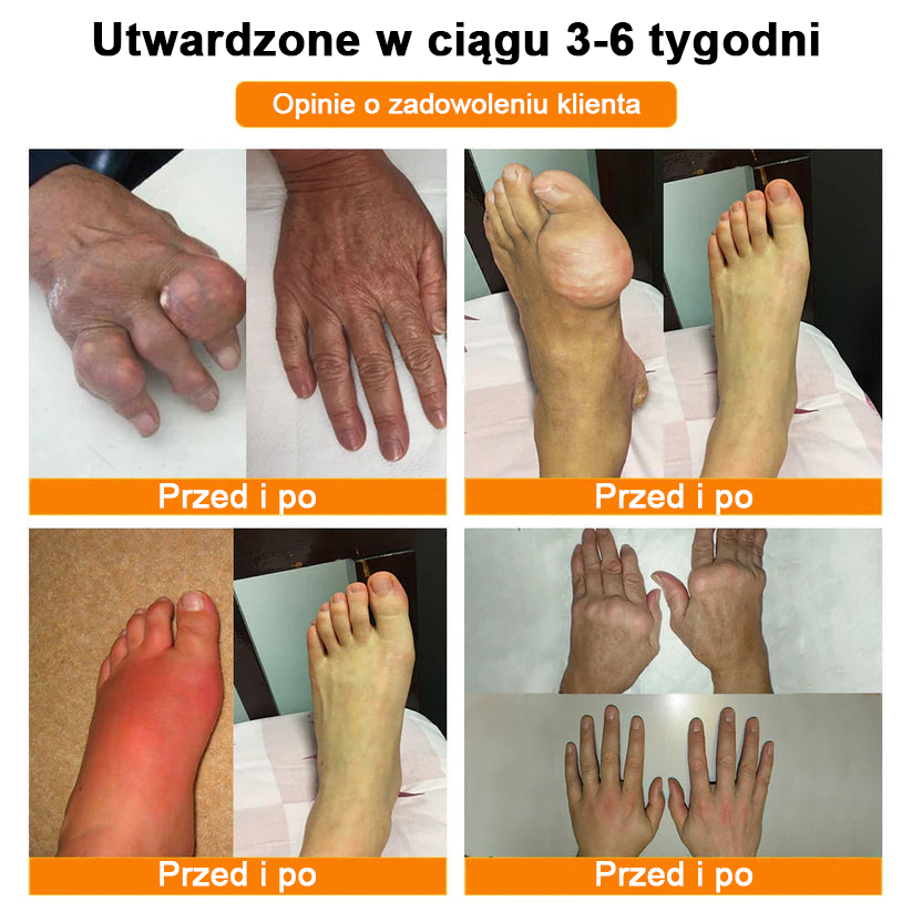 ✨✨✨✨Oficjalny sklep: Ouryard™ Olej magnezowy i miód w sprayu do naprawy stawów👨⚕️Zatwierdzony przez Polską Agencję Leków, Wyrobów Medycznych i Produktów Biologicznych (URPL)🔥