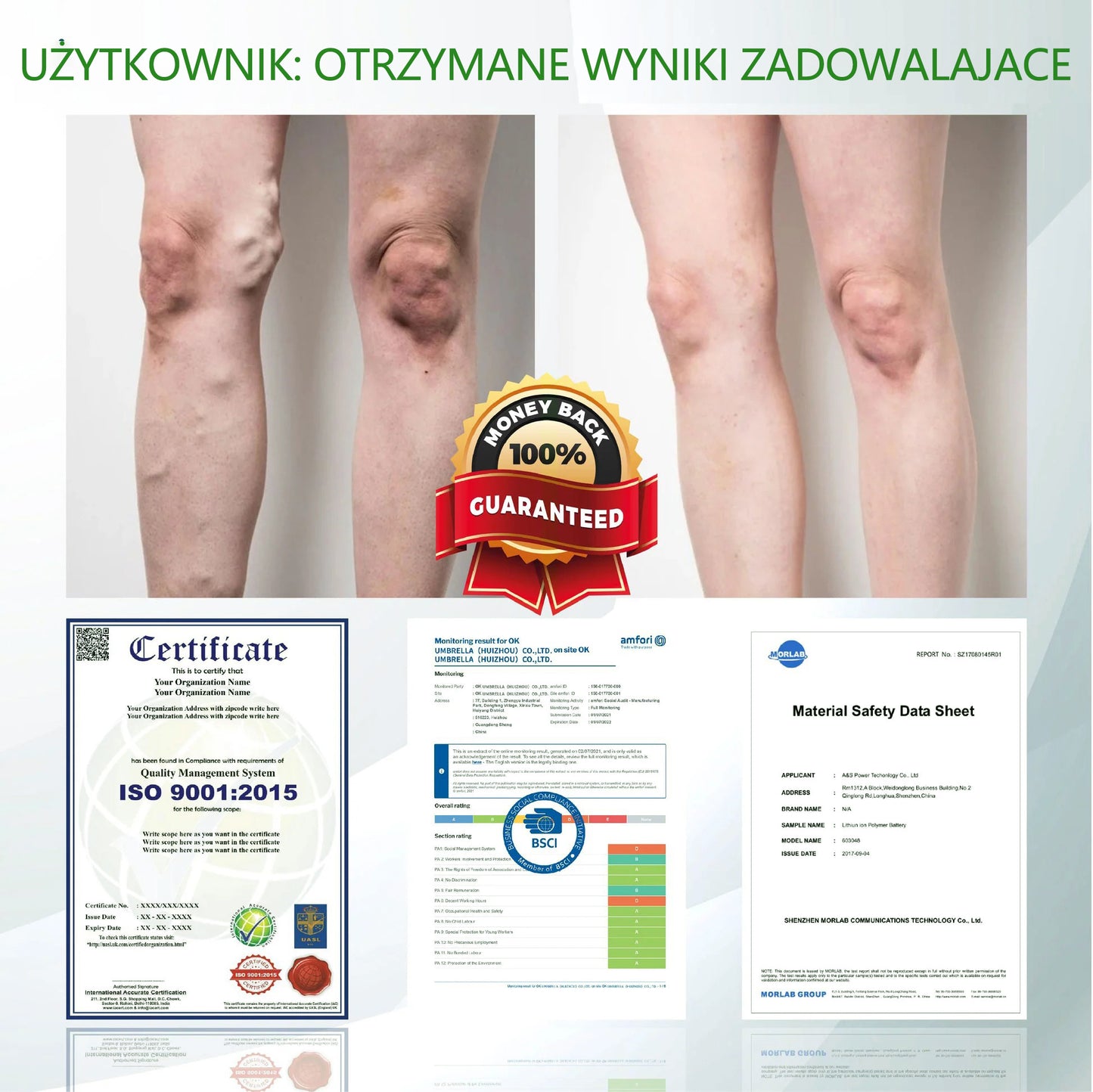 🌿🌿🌿ATTDX® Krem ziołowy łagodzący obrzęki z czarnuszką