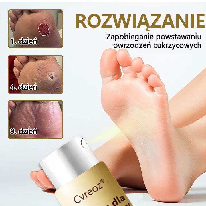 Cvreoz® DiaCure Spray na owrzodzenia stóp cukrzycowych z jadem pszczelim i wąkrotką azjatycką