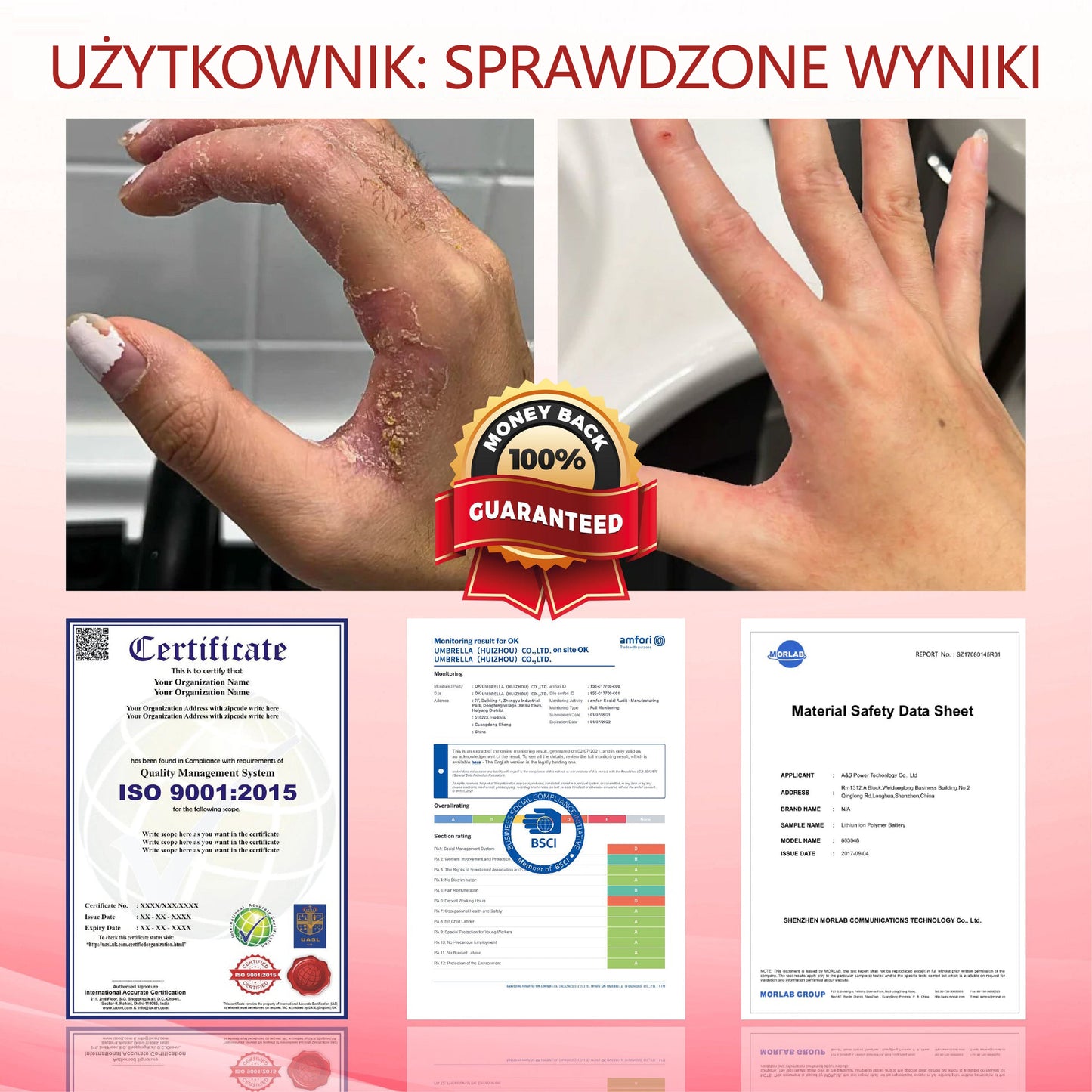 ⭐⭐ATTDX® GlucoseGuard krem ratunkowy dla skóry