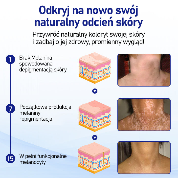 ⭐⭐⭐⭐Timilk® VitiClear Spray ziołowy