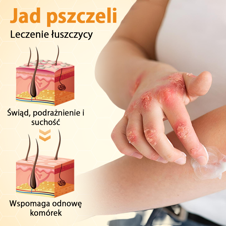 Timilk® BeeLieve Łuszczyca Pielęgnacja skóry🌿🌿🌿