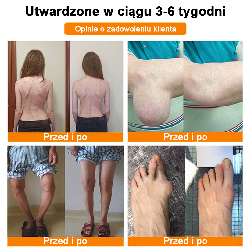 ✨✨✨✨Oficjalny sklep: Ouryard™ Olej magnezowy i miód w sprayu do naprawy stawów👨⚕️Zatwierdzony przez Polską Agencję Leków, Wyrobów Medycznych i Produktów Biologicznych (URPL)🔥