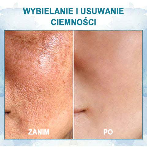 ✨ 60% ZNIŻKI ✨ Fubsta™- B5 LuxeLift młodszy krem ujędrniający