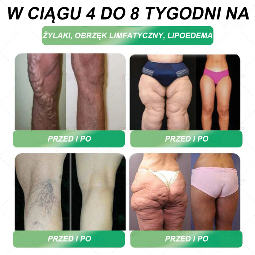 Zalecane przez Centrum Zdrowia w Polsce | Oficjalny sklep 👨⚕️👨⚕️HHVB® GLP-1 doustny roztwór na odchudzanie 💥 Otyłość, choroby układu krążenia, cukrzyca, bezdech senny, problemy ze stawami i inne