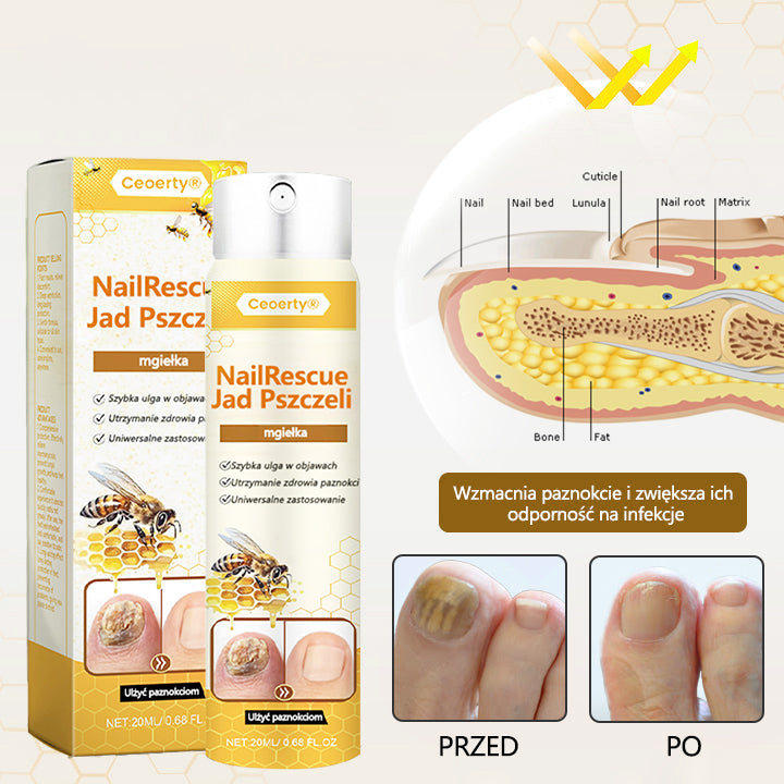 ✅【Oficjalny sklep flagowy】Ceoerty® spray z jadem pszczelim nailrescue