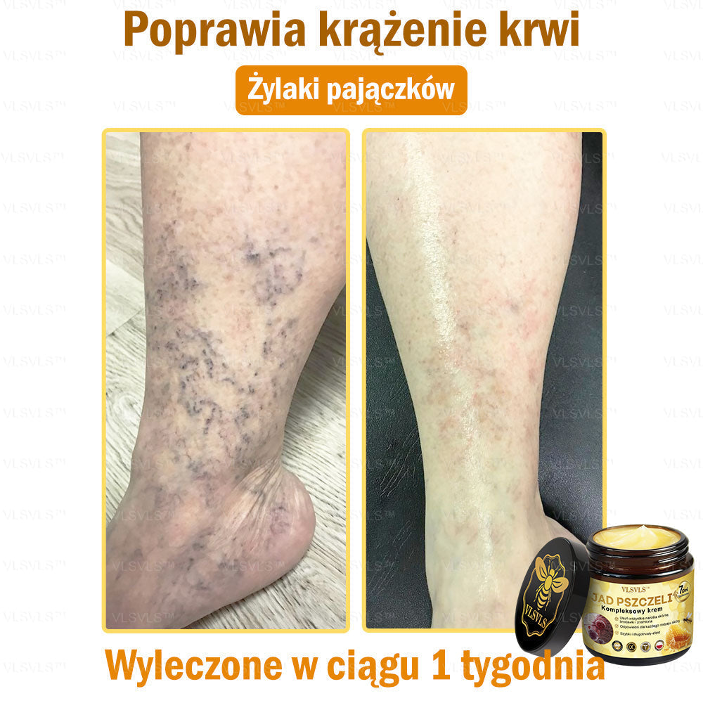 VLSVLS™ Krem Komprehensywny z Jadami Pszczół 🇵🇱 Rekomendowany przez Dermatologów