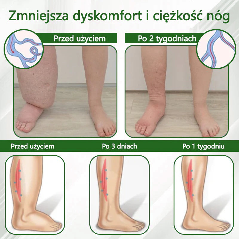 🌿🌿🌿ATTDX® Krem ziołowy łagodzący obrzęki z czarnuszką