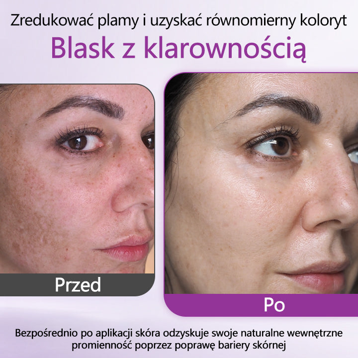 ✅Ceoerty® MelantraX Zaawansowana esencja przeciw przebarwieniom