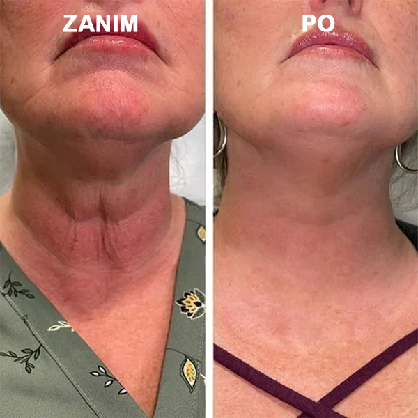 🌿🌿🌿🌿Ostatni dzień promocji 60% Zniżki - Fubsta™ Serum odmładzające ujędrniające skórę🔥🔥🔥🔥