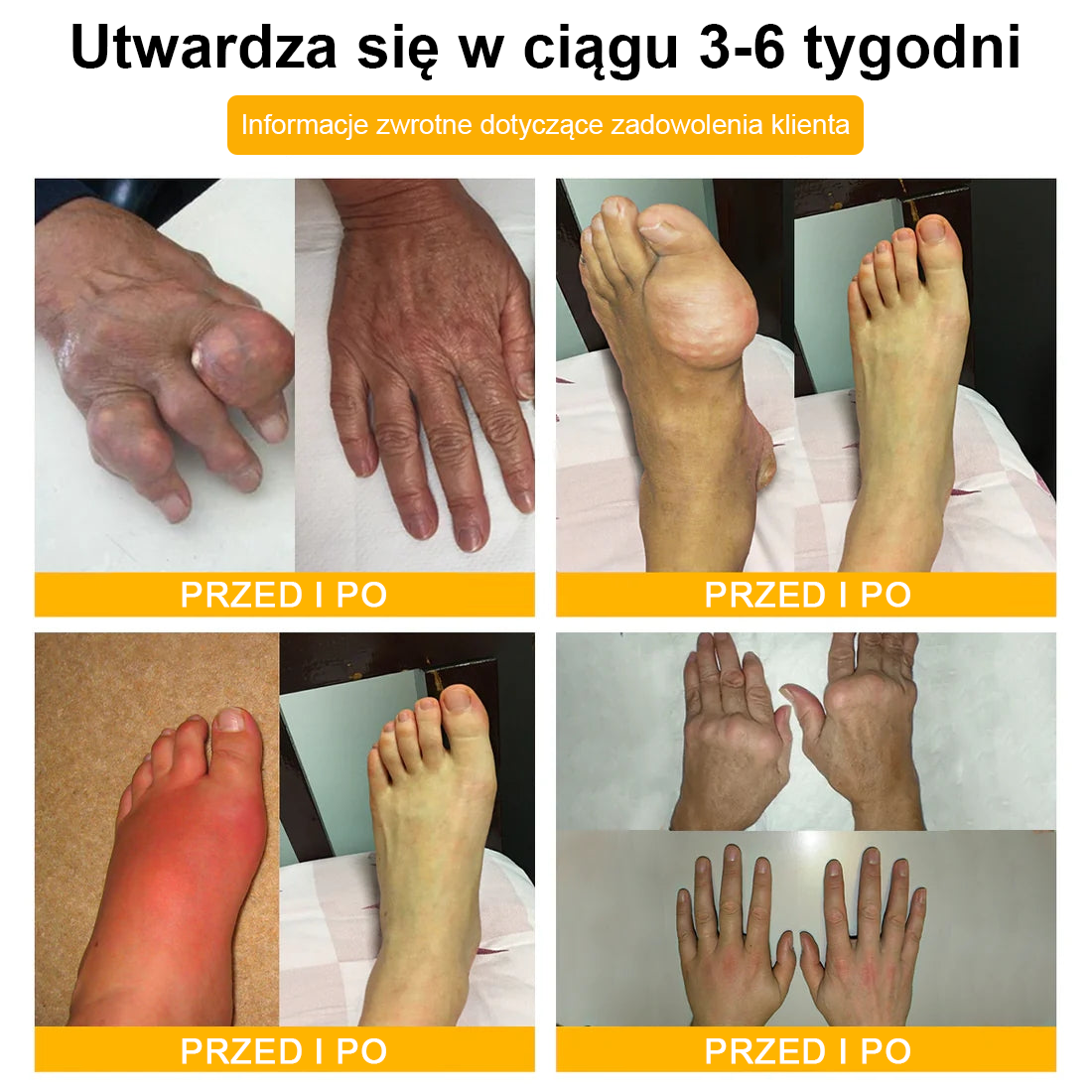 TLOPA® Toksyna botulinowa i jad pszczeli Balsam Łagodzący Ból i Leczenie Kości🐝🐝🌿 (Polecane dla seniorów przez ortopedów)🔥🔥