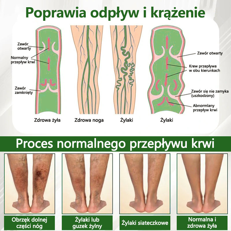 🌿🌿🌿ATTDX® Krem ziołowy łagodzący obrzęki z czarnuszką
