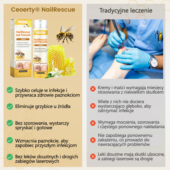 ✅【Oficjalny sklep flagowy】Ceoerty® spray z jadem pszczelim nailrescue