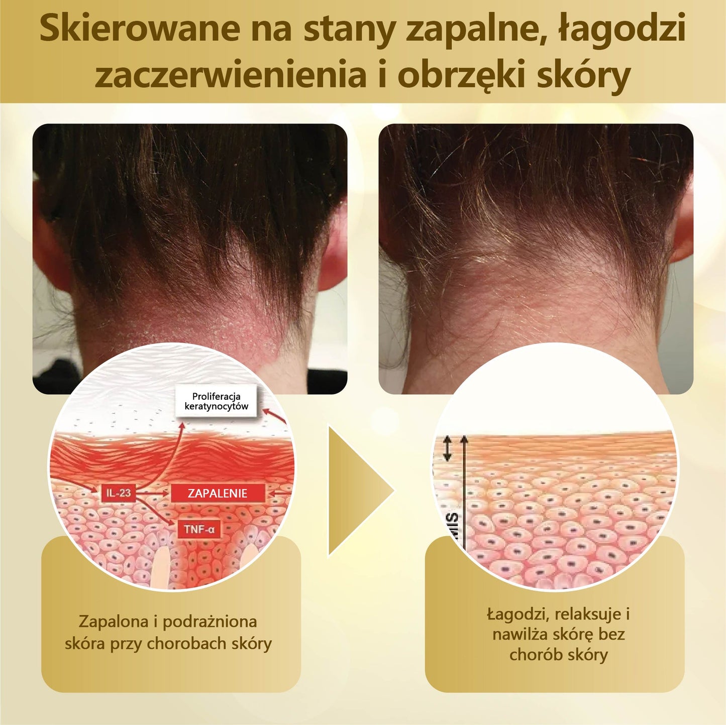 Krem regenerujący skórę Croaie® condense mellifera ⭐️⭐️