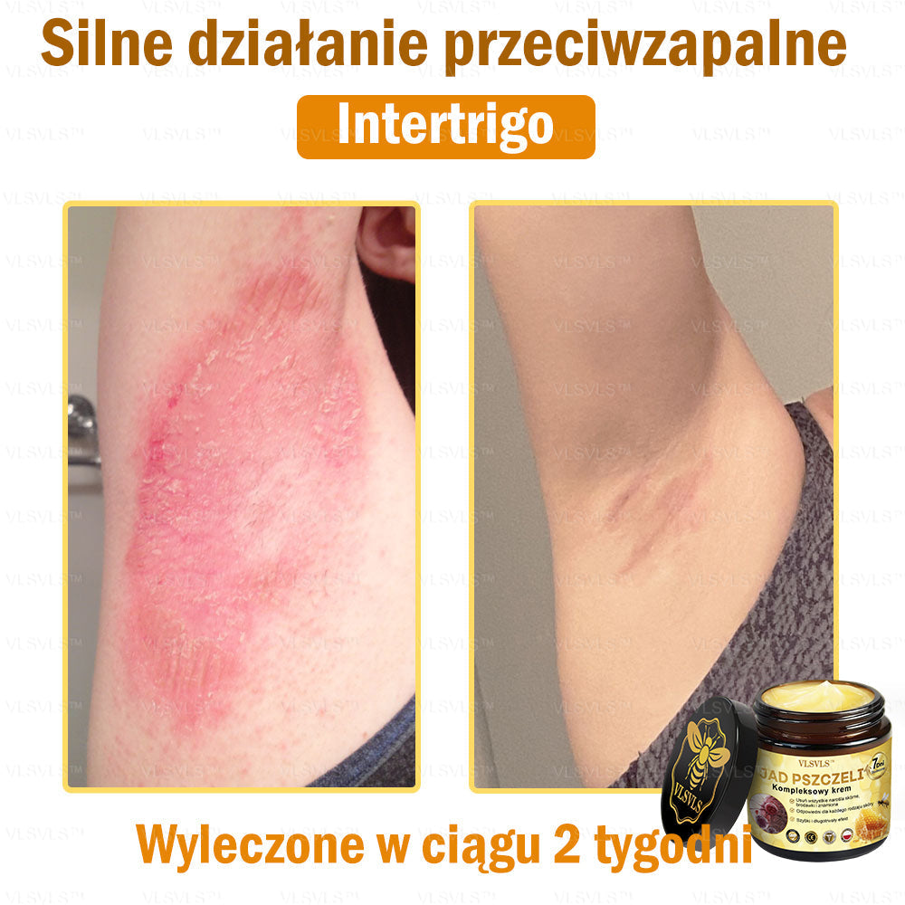 VLSVLS™ Krem Komprehensywny z Jadami Pszczół 🇵🇱 Rekomendowany przez Dermatologów