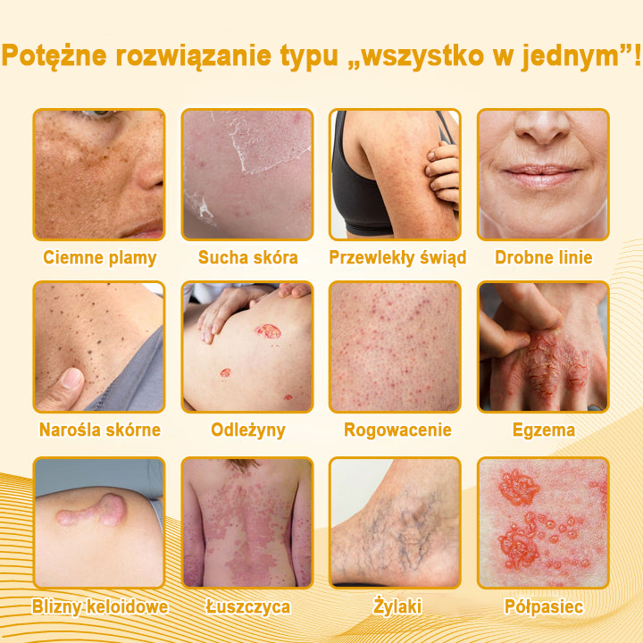 Ceoerty™ Żel antybakteryjny do naprawy skóry - zatwierdzony przez URPL 👨⚕️