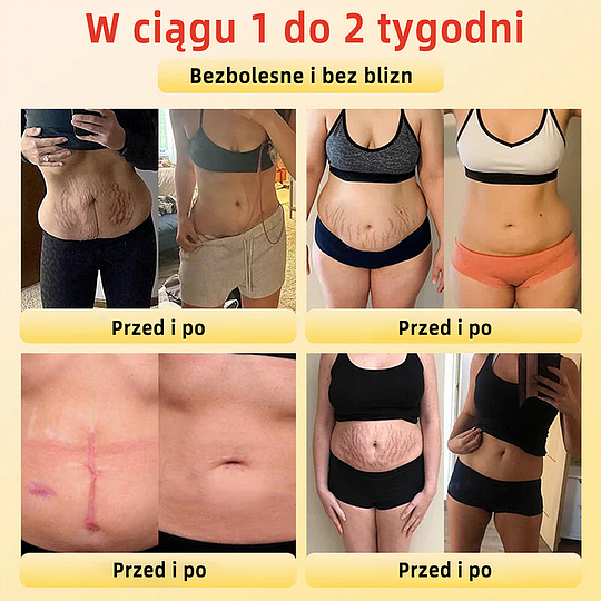 Anyidea™✅ Szorty modelujące z tytanowego włókna medycznego z samodzielnym podgrzewaniem i turmalinem✨✨ (⏰ Ostatnia szansa na zniżkę - ostatnie 30 minut! ⏰)✈️