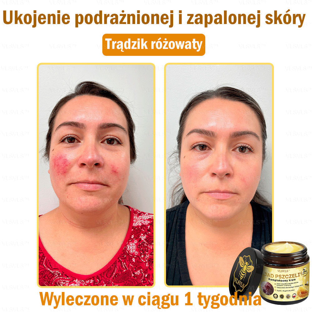 VLSVLS™ Krem Komprehensywny z Jadami Pszczół 🇵🇱 Rekomendowany przez Dermatologów