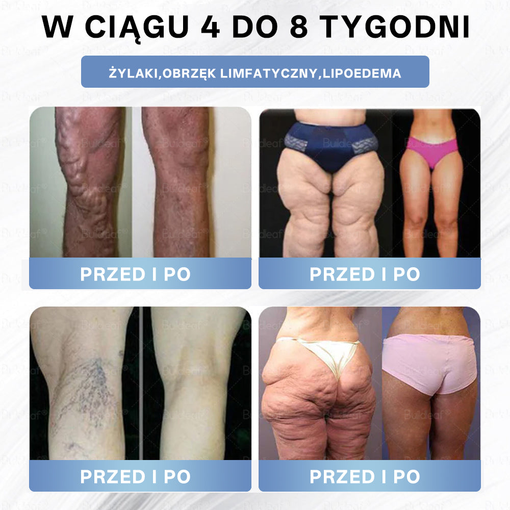 Croaie® Nano Microneedle Patch z SMGT-GLP-1 i Matrixyl 3000 – wyszczuplanie,👨⚕️👨⚕️👨⚕️ ujędrnianie skóry, wsparcie poziomu cukru we krwi, bez zastrzyków, efekty widoczne już po 7 dniach