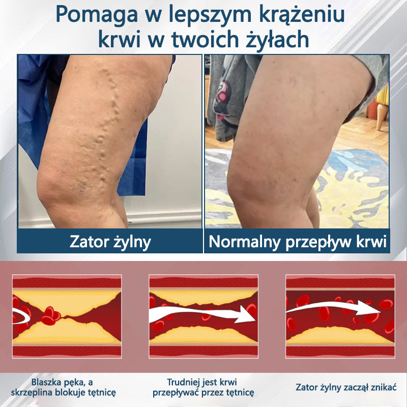 Detoksykujący krem ziołowy z czarnym kminkiem Cvreoz®🩹