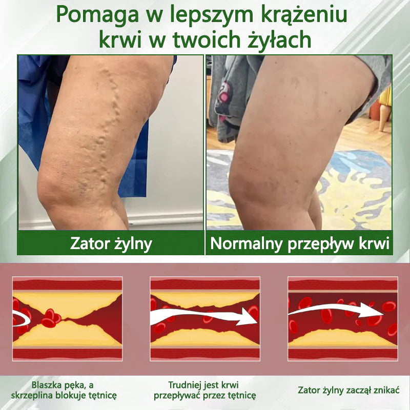 🌿🌿🌿ATTDX® Krem ziołowy łagodzący obrzęki z czarnuszką