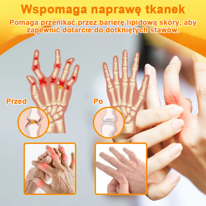 ✨✨✨✨Oficjalny sklep: Ouryard™ Olej magnezowy i miód w sprayu do naprawy stawów👨⚕️Zatwierdzony przez Polską Agencję Leków, Wyrobów Medycznych i Produktów Biologicznych (URPL)🔥