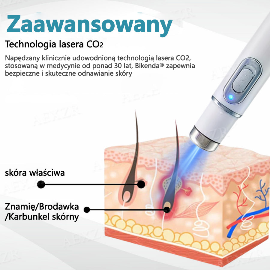 Bikenda® NOWOŚĆ Nieinwazyjny laser do usuwania pieprzyków i brodawek🔥🔥🔥