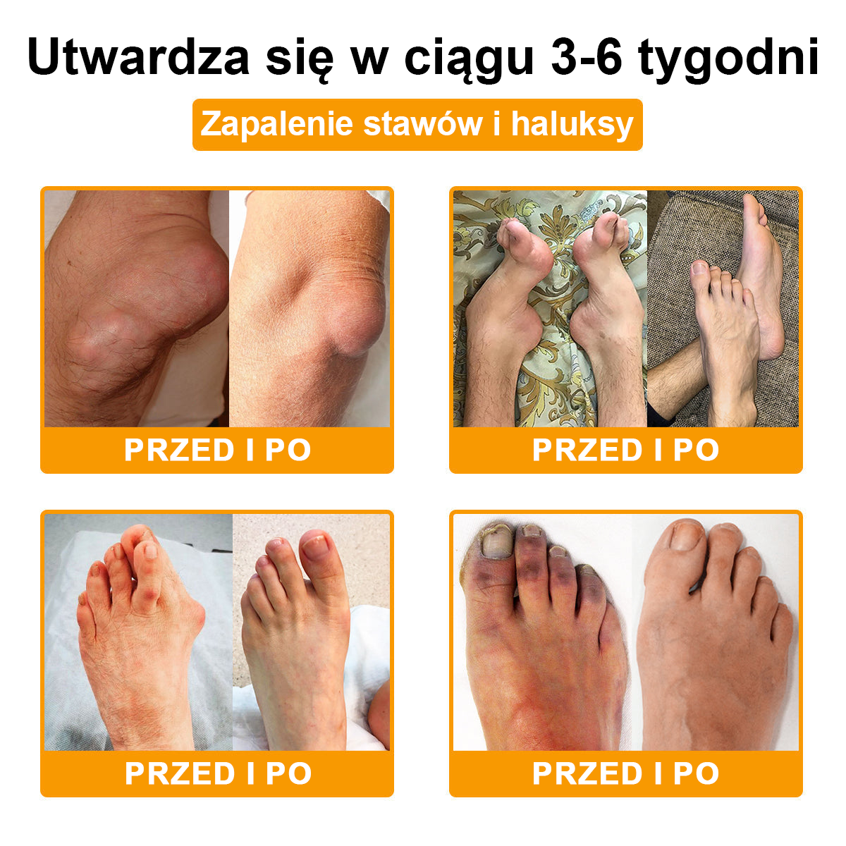 TLOPA® Toksyna botulinowa i jad pszczeli Balsam Łagodzący Ból i Leczenie Kości🐝🐝🌿 (Polecane dla seniorów przez ortopedów)🔥🔥