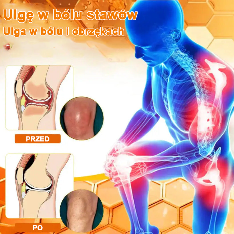 ✨✨✨✨Oficjalny sklep: Ouryard™ Olej magnezowy i miód w sprayu do naprawy stawów👨⚕️Zatwierdzony przez Polską Agencję Leków, Wyrobów Medycznych i Produktów Biologicznych (URPL)🔥