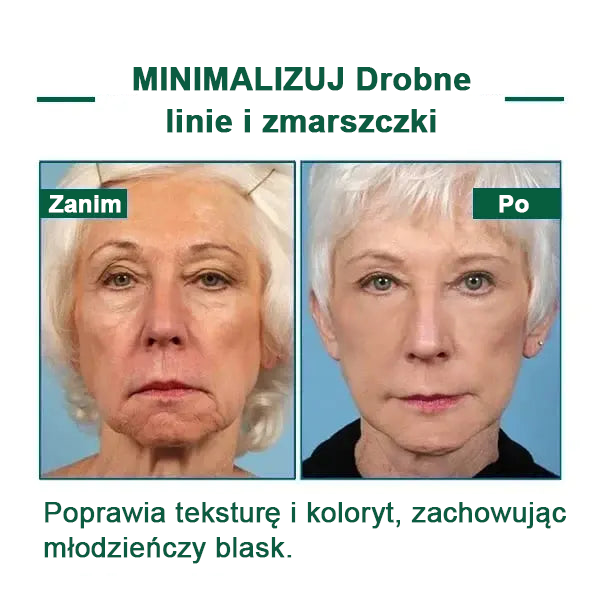 🌿🌿🌿🌿Ostatni dzień promocji 60% Zniżki - Fubsta™ Serum odmładzające ujędrniające skórę🔥🔥🔥🔥