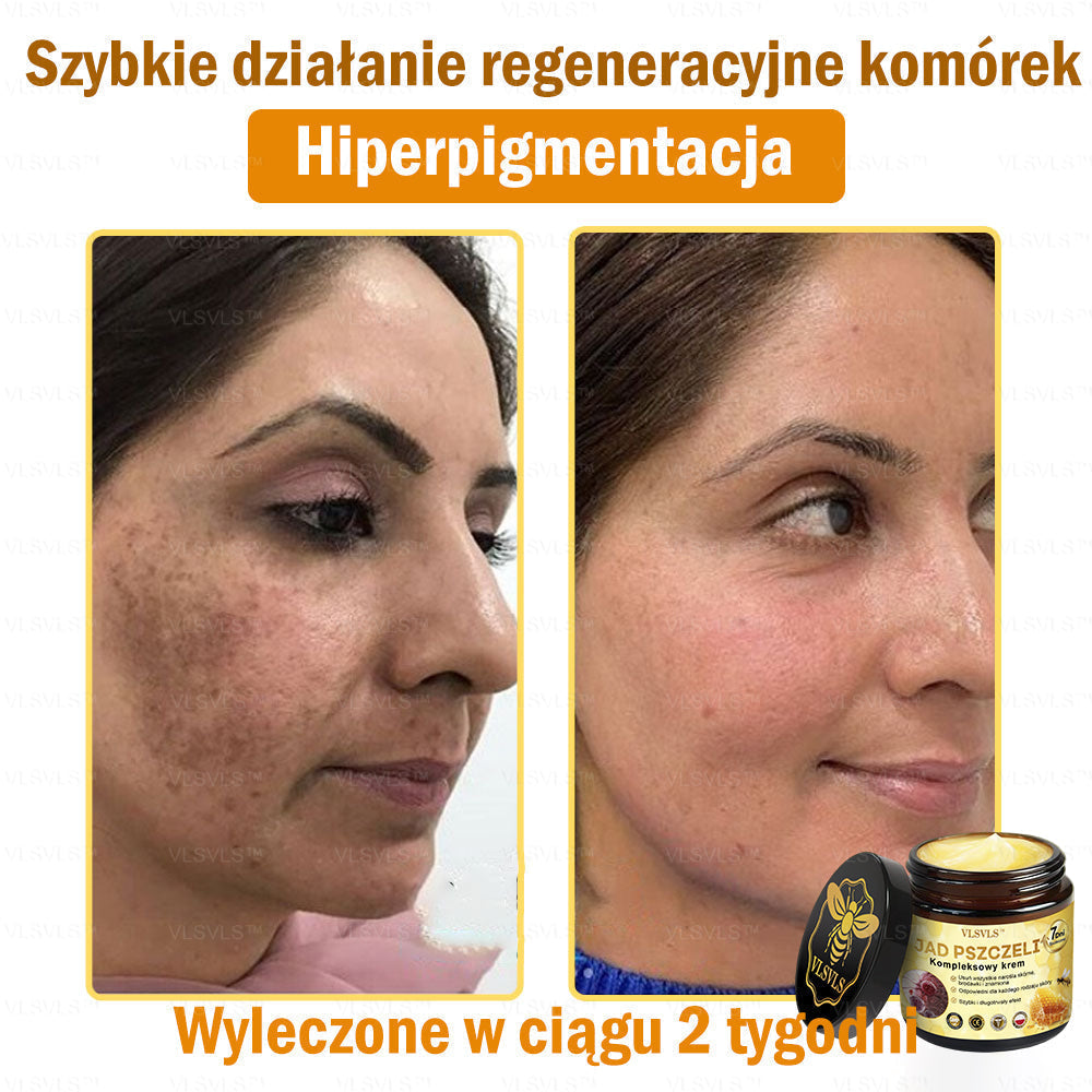 VLSVLS™ Krem Komprehensywny z Jadami Pszczół 🇵🇱 Rekomendowany przez Dermatologów