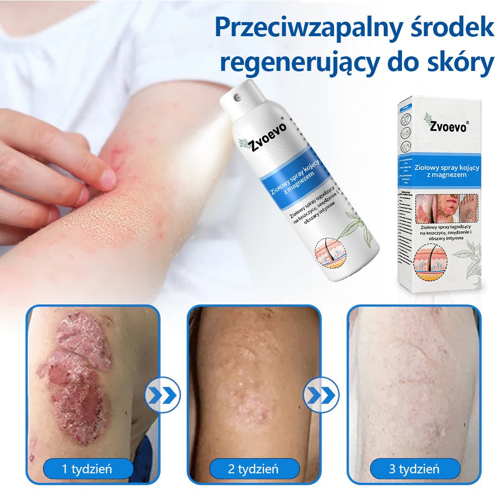 Oficjalny sklep✅: Zvoevo®Magnezowy spray ziołowy na łuszczycę⚕️Certyfikowany przez URPL (ulga w łuszczycy i egzemie, poprawa stanu bakteryjnych infekcji narządów płciowych oraz leczenie trądziku i przebarwień)✨✨✨✨