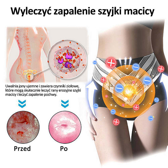 Anyidea™✅ Szorty modelujące z tytanowego włókna medycznego z samodzielnym podgrzewaniem i turmalinem✨✨ (⏰ Ostatnia szansa na zniżkę - ostatnie 30 minut! ⏰)✈️