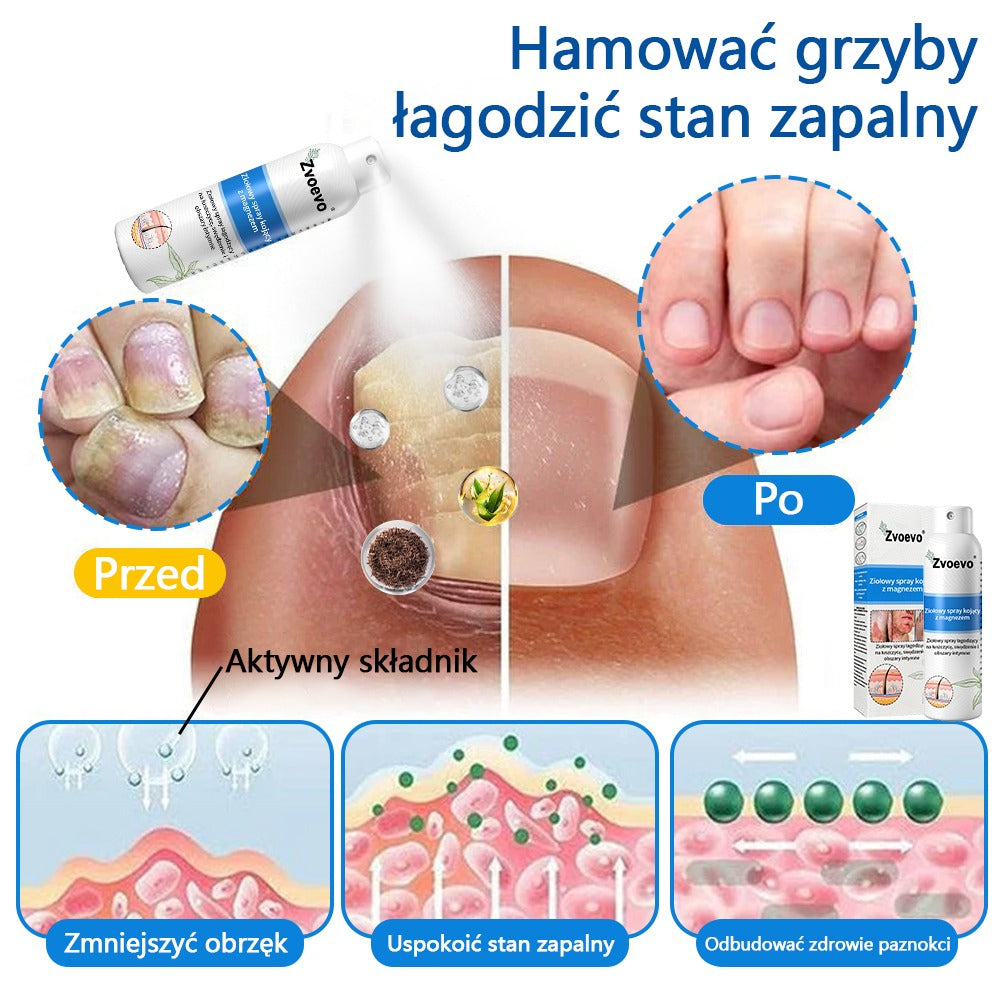 Oficjalny sklep✅: Zvoevo®Magnezowy spray ziołowy na łuszczycę⚕️Certyfikowany przez URPL (ulga w łuszczycy i egzemie, poprawa stanu bakteryjnych infekcji narządów płciowych oraz leczenie trądziku i przebarwień)✨✨✨✨