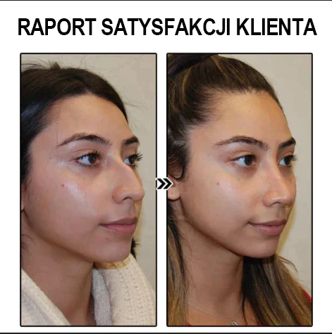 (Ostatni dzień wyprzedaży - 80% zniżki)Kolczyki germanowe Bikenda™ Lymphvity MagneTherapy🔥