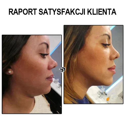 (Ostatni dzień wyprzedaży - 80% zniżki)Kolczyki germanowe Bikenda™ Lymphvity MagneTherapy🔥