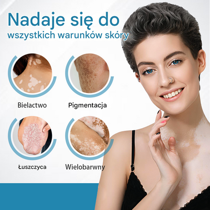 ✅Urządzenie do terapii bielactwa Bikenda® DermaBeam