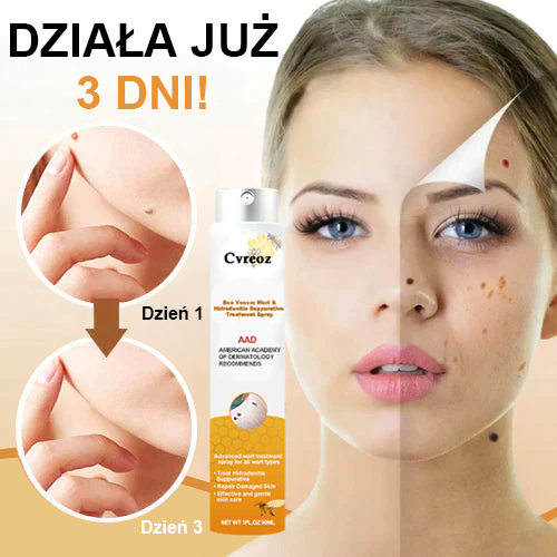 🧡Cvreoz Preparat do usuwania brodawek i znamion z jadem pszczelim Spray (👨‍⚕AAD POLECA)🐝🐝 (🔥Ostatni dzień promocji 80% taniej)