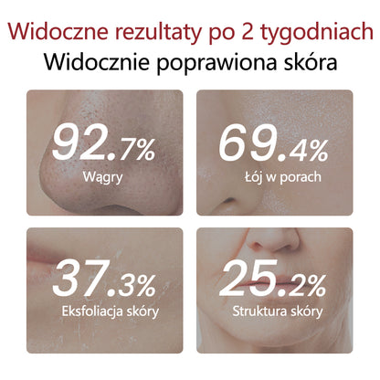 Ampułka Biancat® Peel Shot Glow Black Rice🌿🌿
