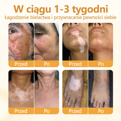 Timilk® VitiCalm krem z jadem pszczelim🌻🌻🌻