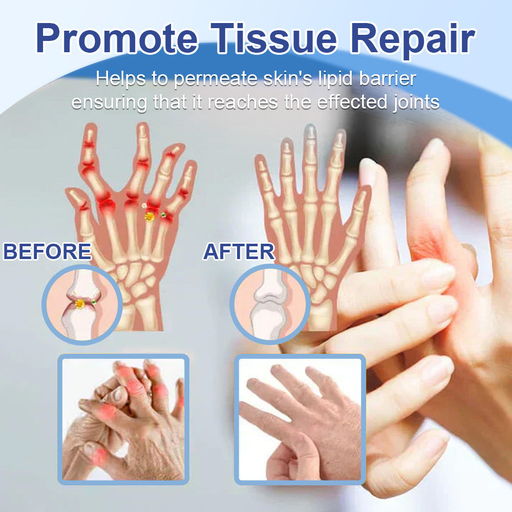 ✅ HSE Approved: Ourlyard® Magnesium Pain Healing Bone Cream (Treatment for arthritis, neuropathyy, rheumatic diseases, muscle spasms, twitches and sports injuries)