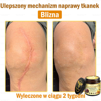 VLSVLS™ Krem Komprehensywny z Jadami Pszczół 🇵🇱 Rekomendowany przez Dermatologów