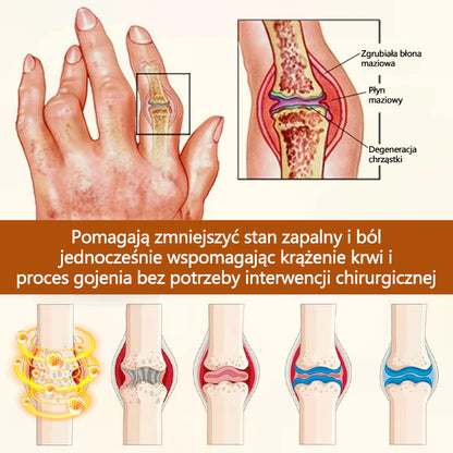 🔥🔥Timilk® VenomEase Krem do stawów