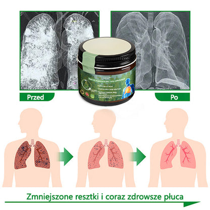 [Noworoczna oferta specjalna] Lercea™ Krem regenerujący płuca z dziewanny💥 💥- zatwierdzony przez British Thoracic Society w celu wspierania zdrowia płuc👑👑